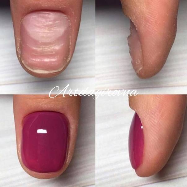 Почему на ногтях трескается гель-лак (шеллак): причины и профилактика