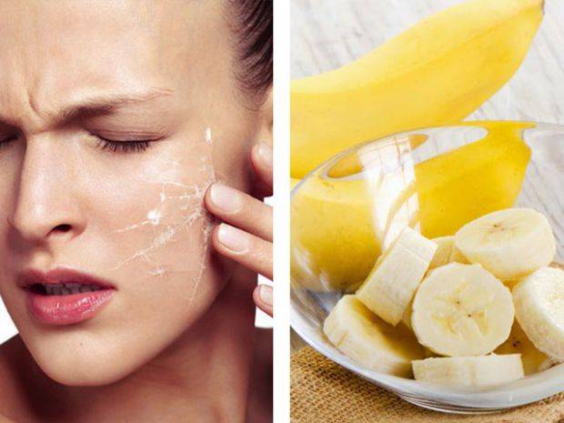 Как сделать маски от шелушения? домашние рецепты для кожи