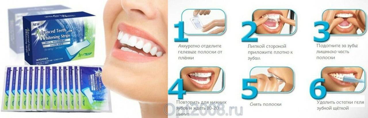 Отбеливающие полоски для зубов: эффективность и правила пользования