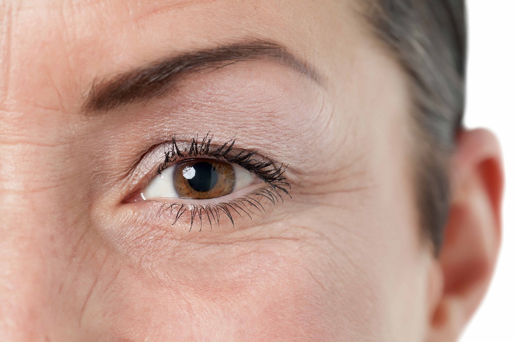 Как уменьшить мимические морщины на лице и вокруг глаз | evolution