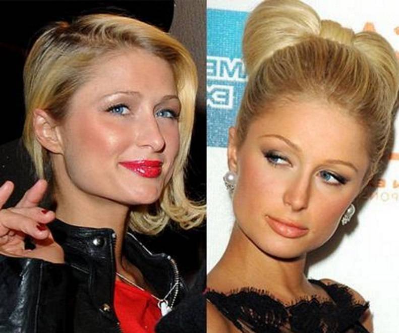 15 знаменитостей с шокирующими дефектами внешности, о которых вы и не подозревали