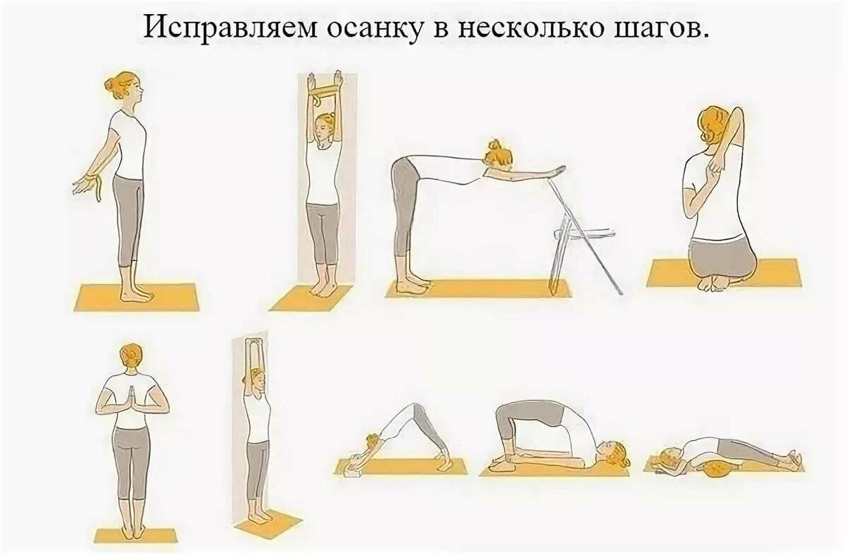 Противопоказания при сколиозе к физическим нагрузкам