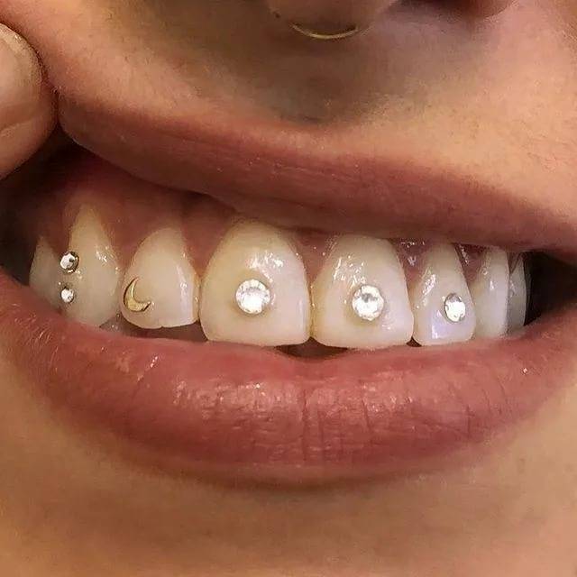 Скайс на зуб — зубы