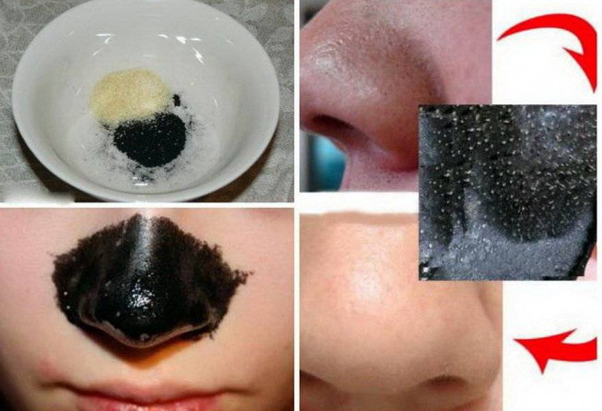 Маска из желатина и активированного угля – рецепт для лица