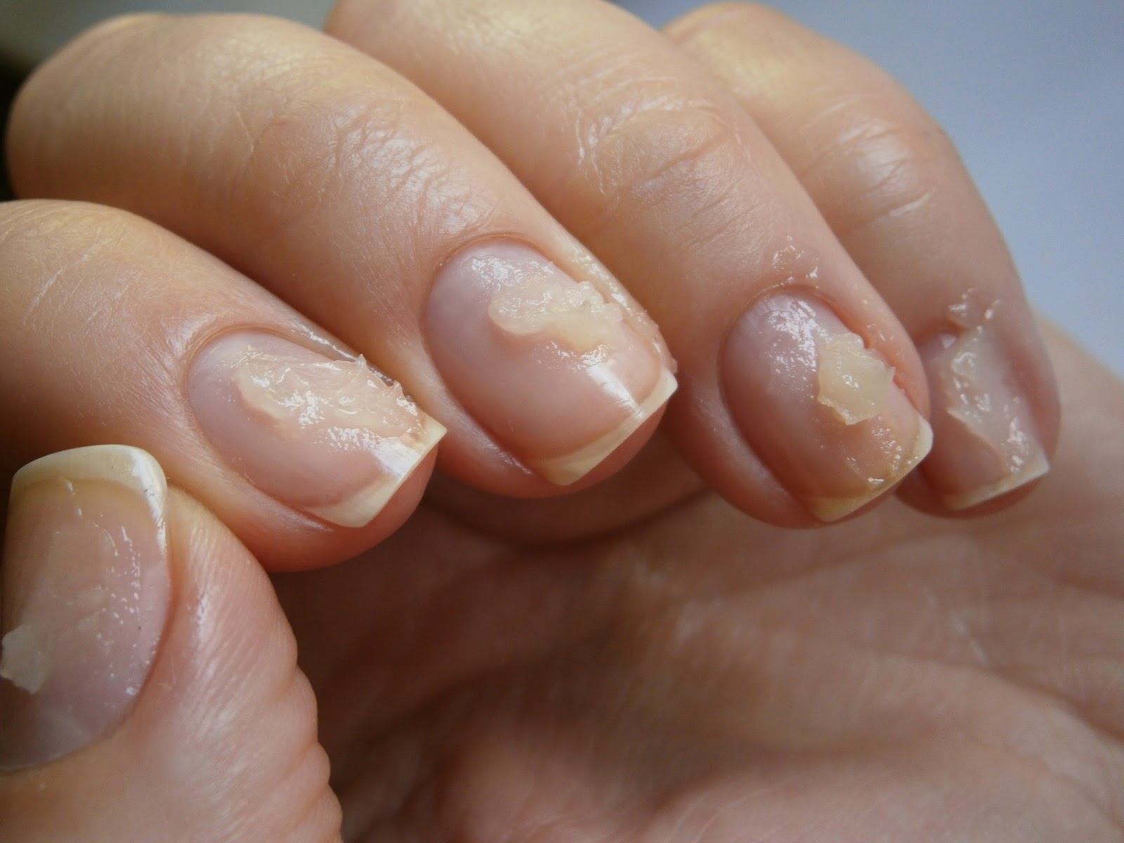Как восстановить ногти после гель-лака: 6 лучших советов от мастера
