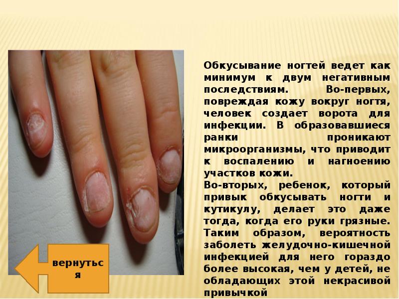 Желтые ногти на руках – причины