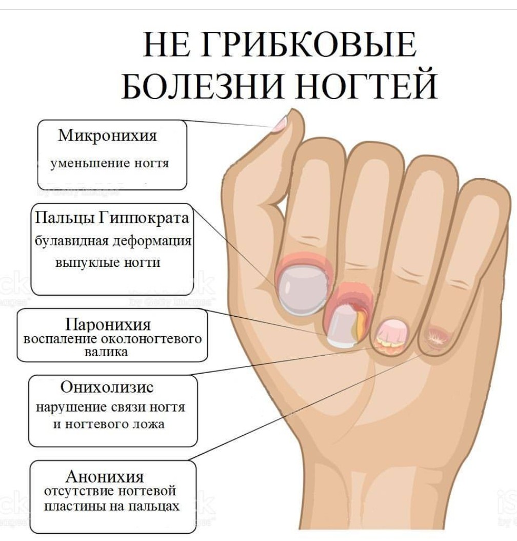 Здоровье по ногтям рук таблица рисунок