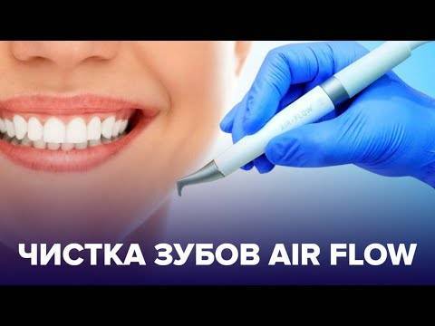 Чистка зубов системой air flow | алтейдент