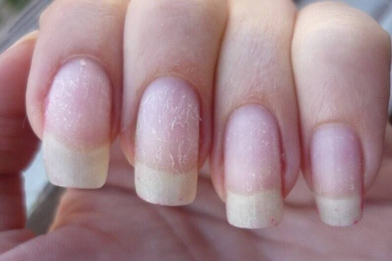 Как восстановить ногти после наращивания в домашних условиях » womanmirror
как восстановить ногти после наращивания в домашних условиях