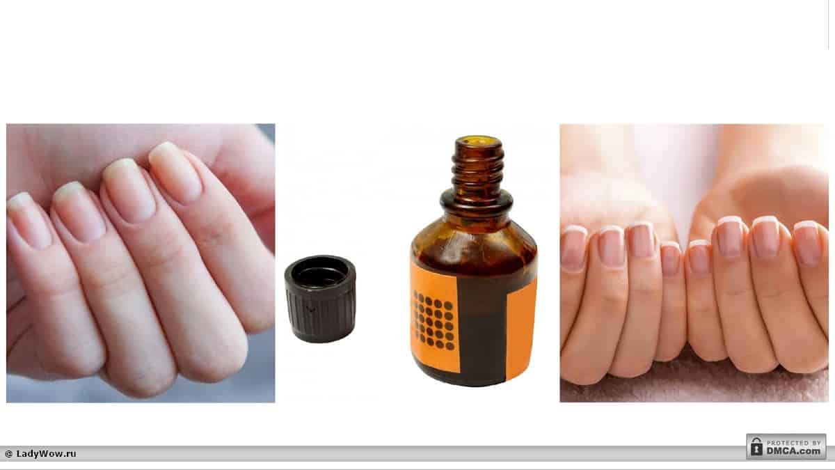 Йод для ногтей: польза и вред, лечение