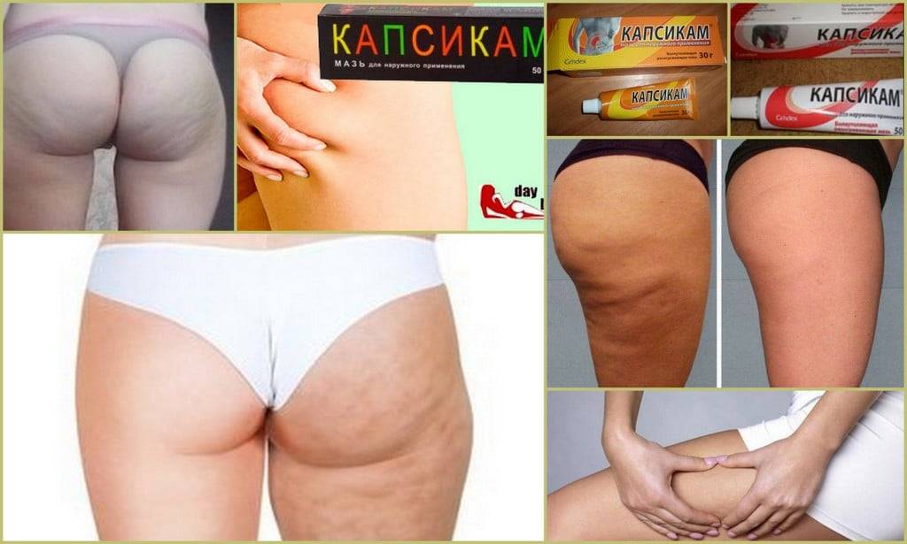 Самые эффективные салонные процедуры от целлюлита ✔️ блог клиники лица