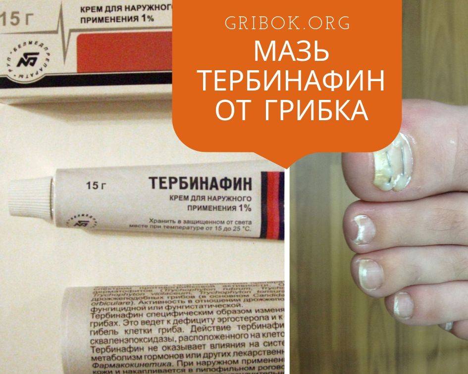 Кремы от грибка ногтей тербинафин, экзодерил, ламизил, низорал, микозан: эффективные противогрибковые средства