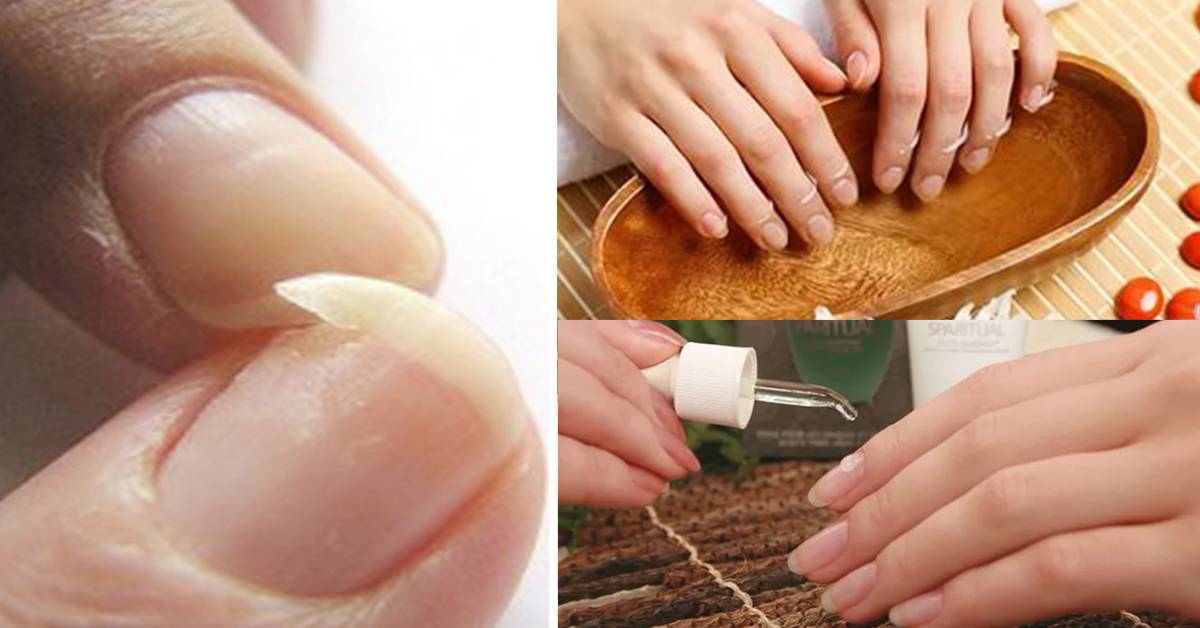 Восстановление ногтей после наращивания: рецепты и советы