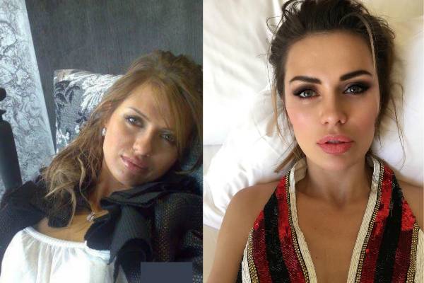 Виктория боня до и после пластических операций, фото и видео » womanmirror