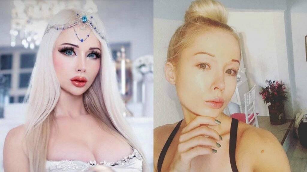 Валерия лукьянова до и после пластики: как выглядела «одесская барби» перед операциями (фото)