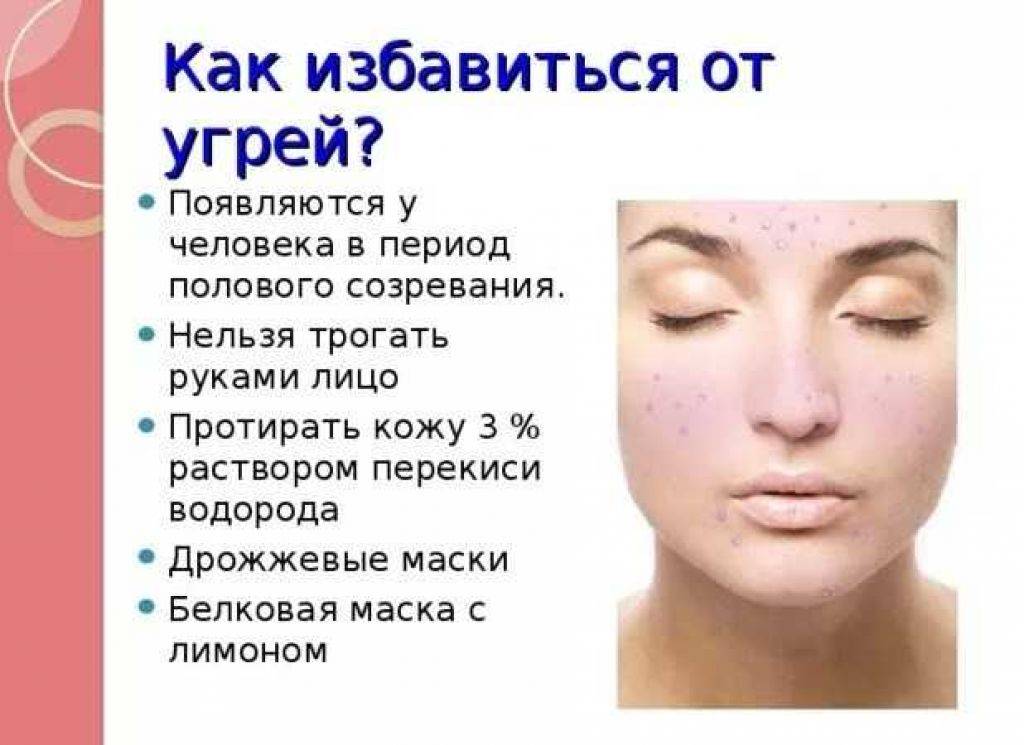 Причины и лечение угревой сыпи на лице: питание, маски, чистка