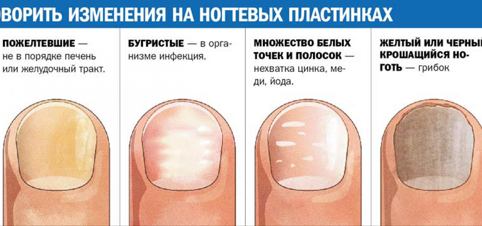 Диагностика по ногтям пальцев рук: по цвету форме структуре