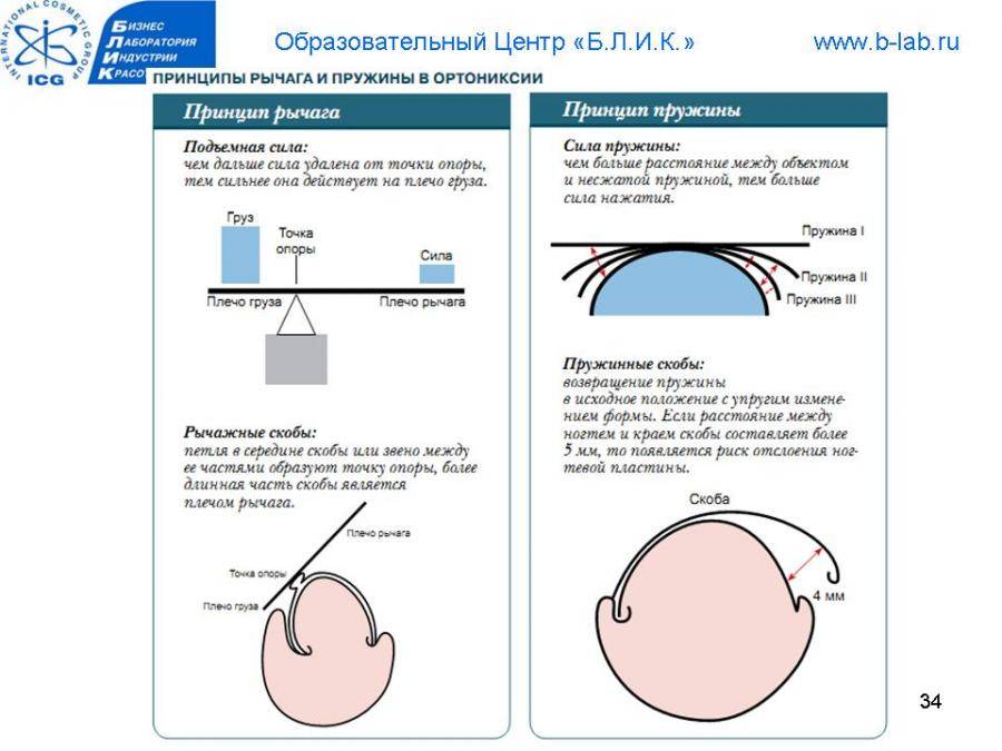 Обработка вросшего ногтя схема