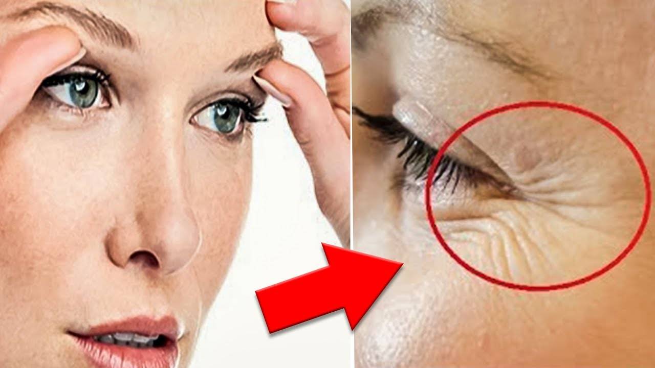 Как навсегда избавиться мешков под глазами? как быстро убрать морщины, грыжи, синяки и мешки под глазами без операции?