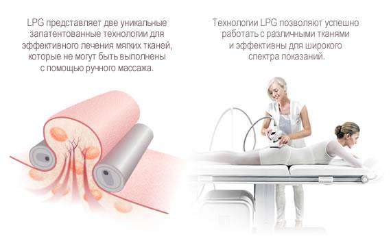 Lpg массаж лица, быстрый способ подтянуть и тонизировать кожу без операций санкт-петербурге — биомед