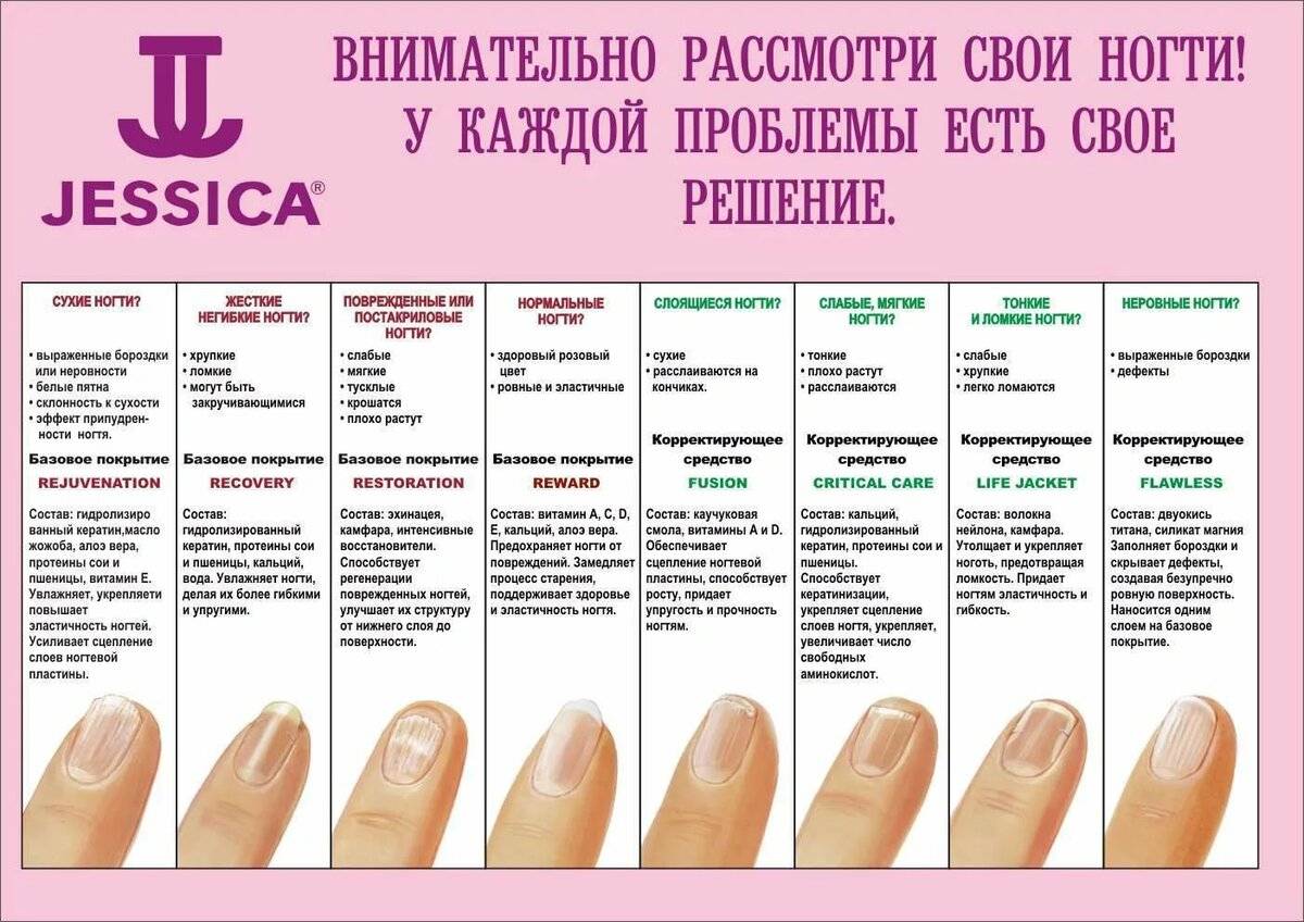 Типсы на ногти: как выбрать, как наклеить, как ухаживать и, самое главное, как снять? | красота и здоровье | школажизни.ру