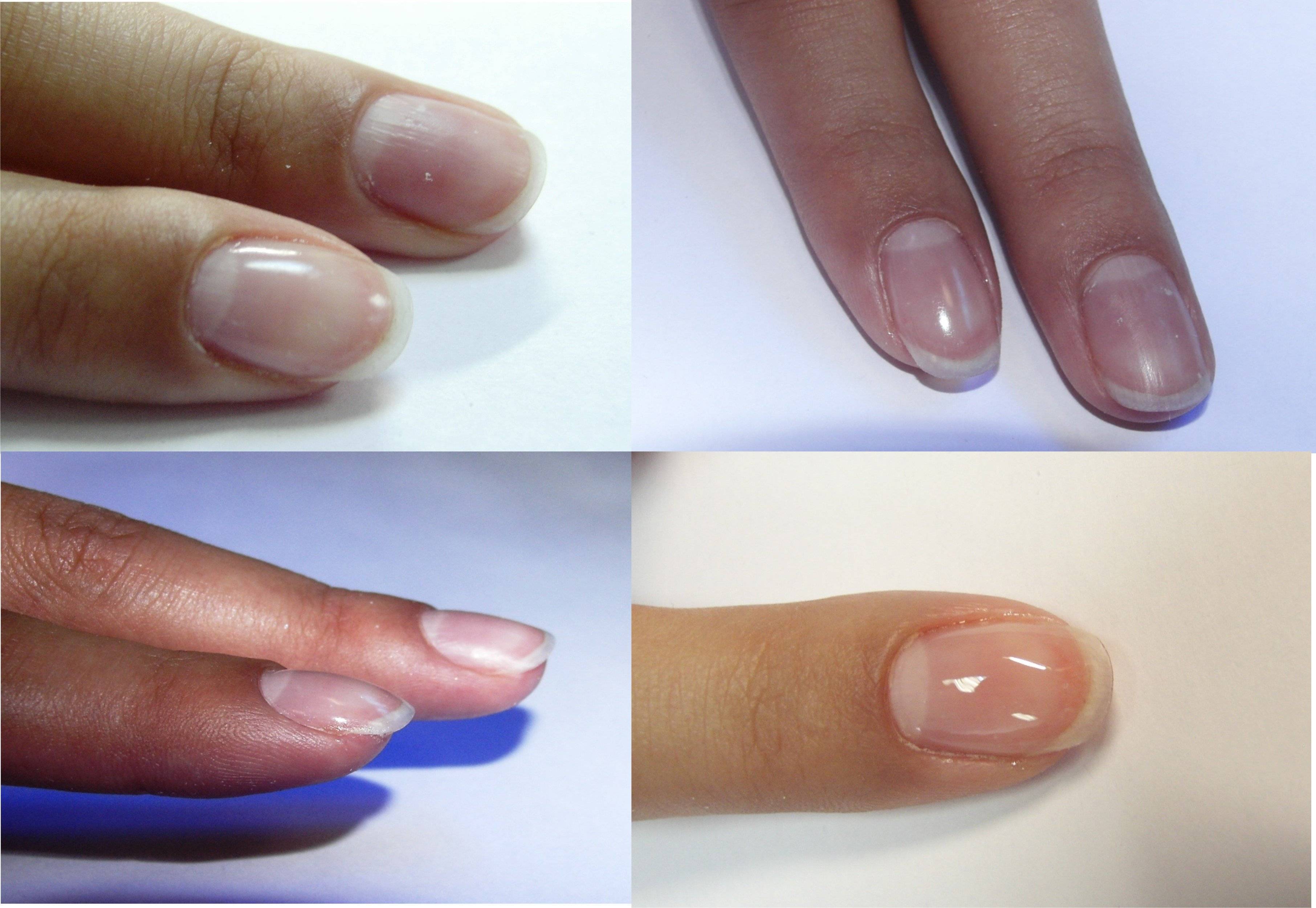 Укрепление ногтей биогелем или шеллаком. чем лучше? | красивые ногти - дополнение твоего образа