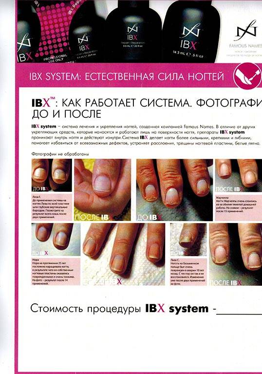Лечение ногтей в орле. ibx system