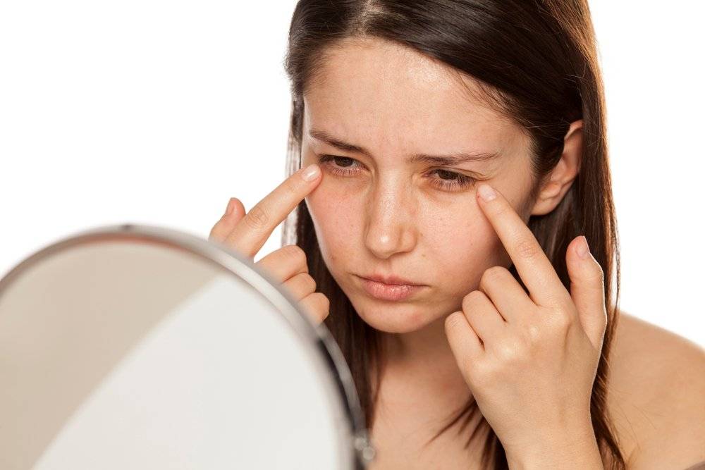 Аллергия на глазах – причины и симптомы аллергического конъюнктивита