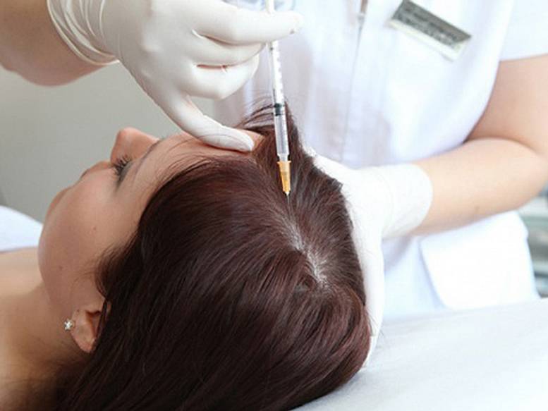 Фракционная мезотерапия - клиника «доктор волос»
