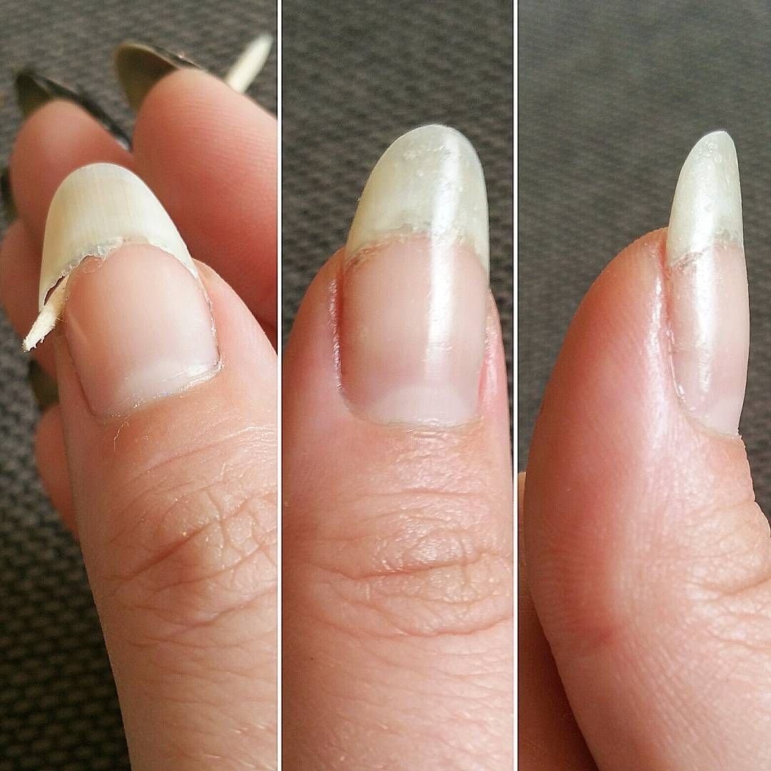 Как исправить форму ногтей?
