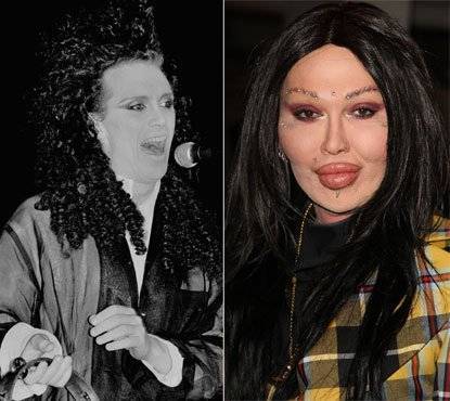 Женщина, которая сделала более 52 пластических операций: фото до и после