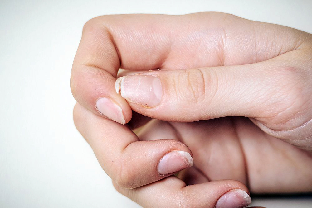 Как проверить щитовидку? три симптома гипотиреоза на ногтях!