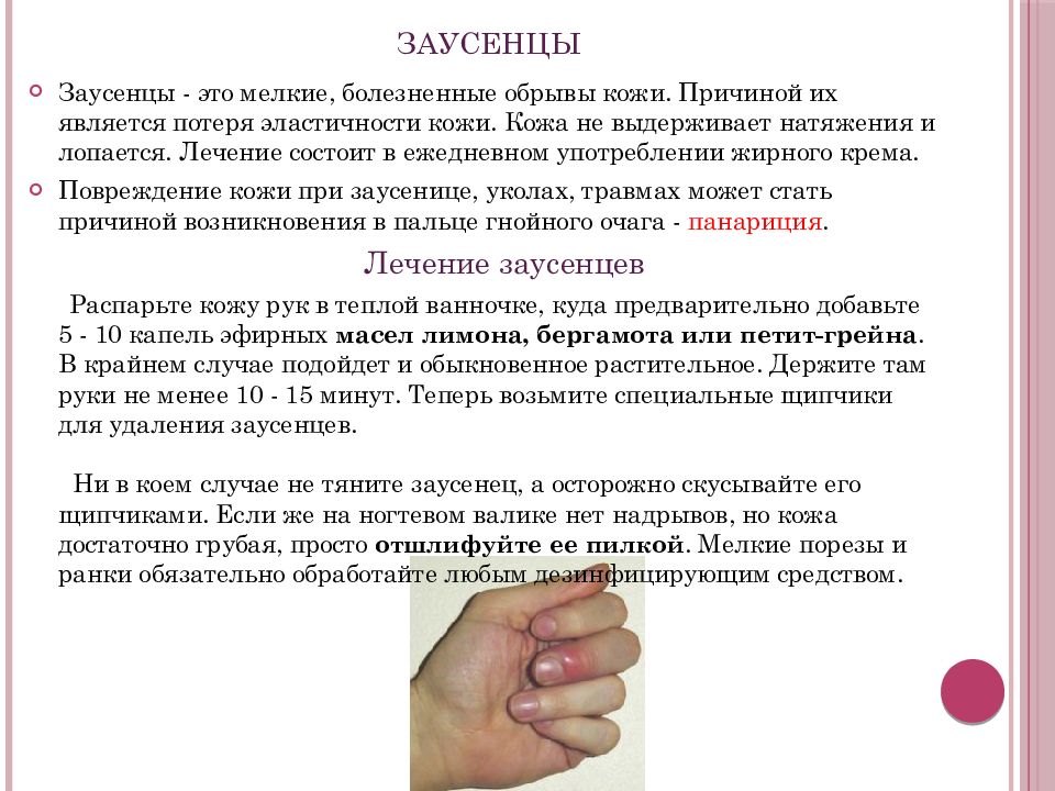 Вскрытие панариция: необходимая подготовка, ход приема хирурга и противопоказания | услуги клиники «проксима» (г. сочи)
