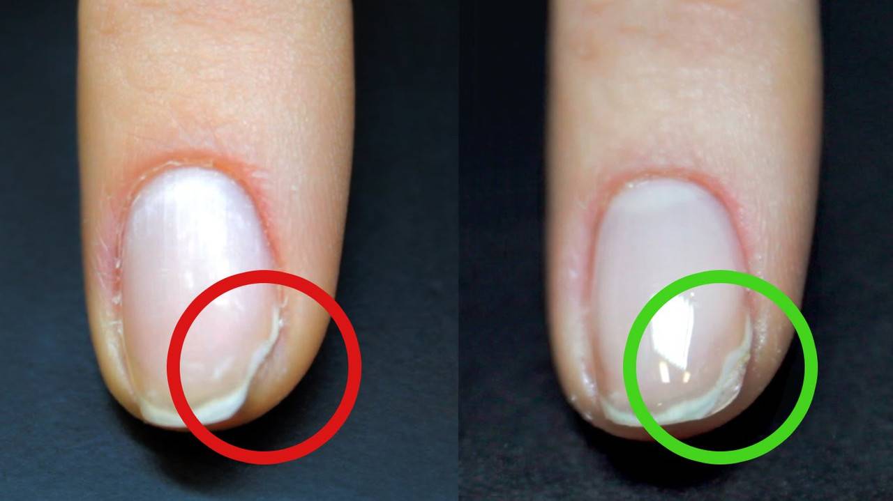 Причины отслоения геля-лака на ногтях