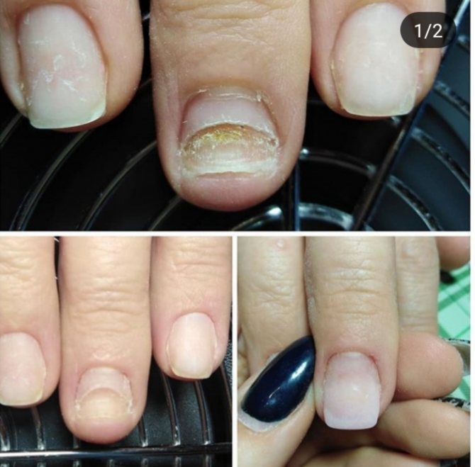 Почему нарощенные ногти быстро отваливаются