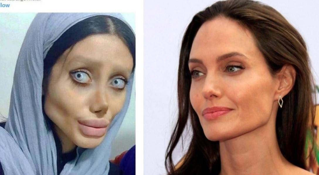 Анджелина джоли до и после пластики: фото актрисы, делала ли она пластические операции, новости и фото 2019