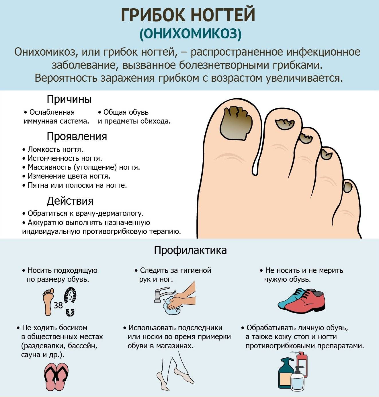 Полезная справка для пациентов: симптомы грибка ногтей на ногах