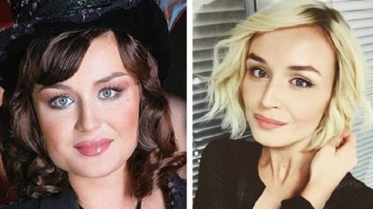 Полина гагарина до и после пластики: фото без макияжа и стрижка (прическа) певицы
