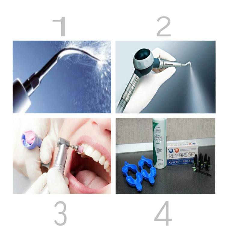 Комплексная профессиональная гигиена (чистка) зубов: ультразвук + air flow + фторирование.