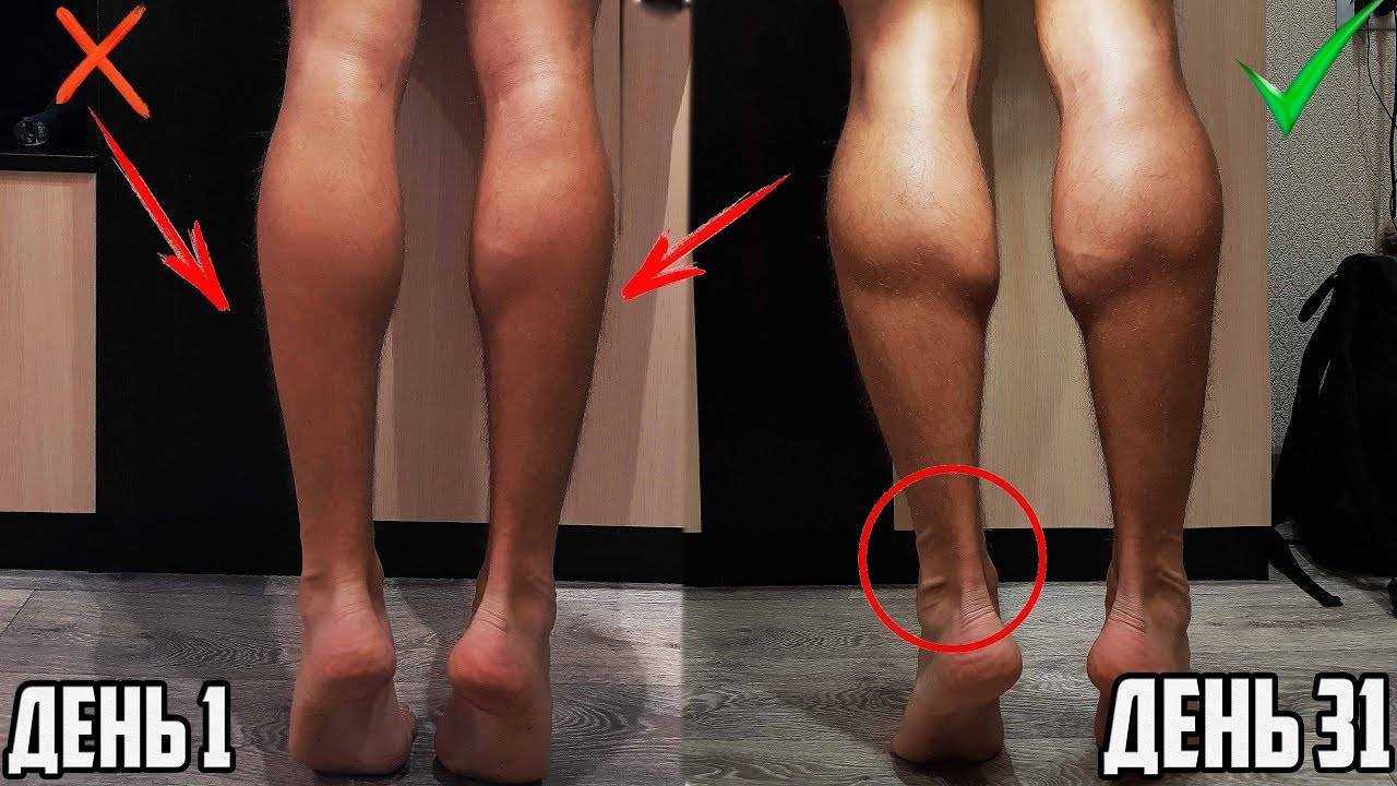 Как уменьшить икры на ногах: упражнения для девушек