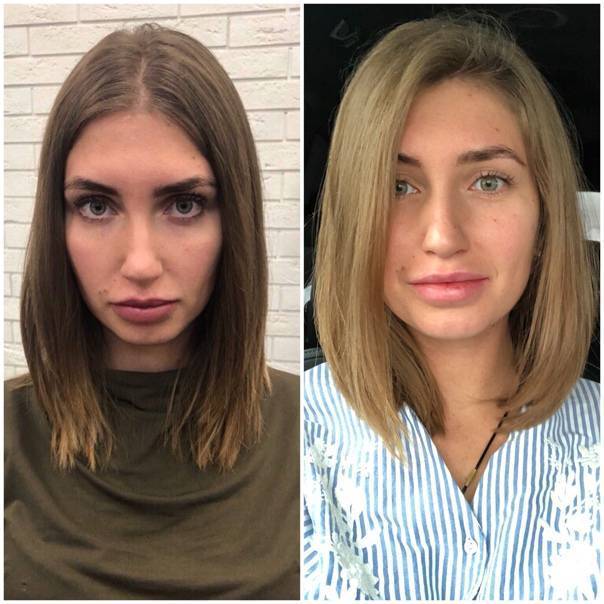 Буст ап: фото до и после boost up, прикорневой объем волос, отзывы что это такое