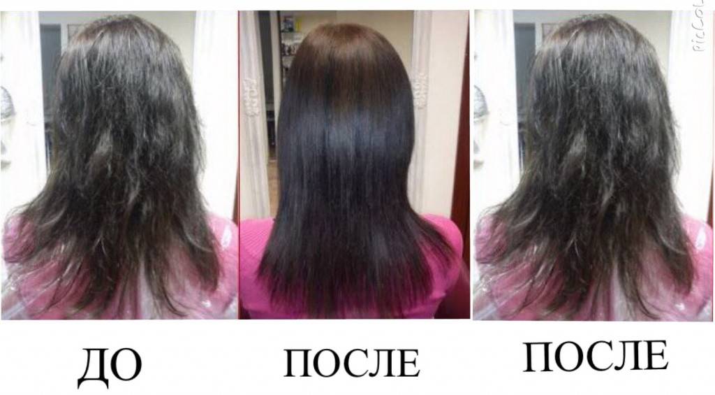 Благоприятный прогноз: последствия ботокса для волос
