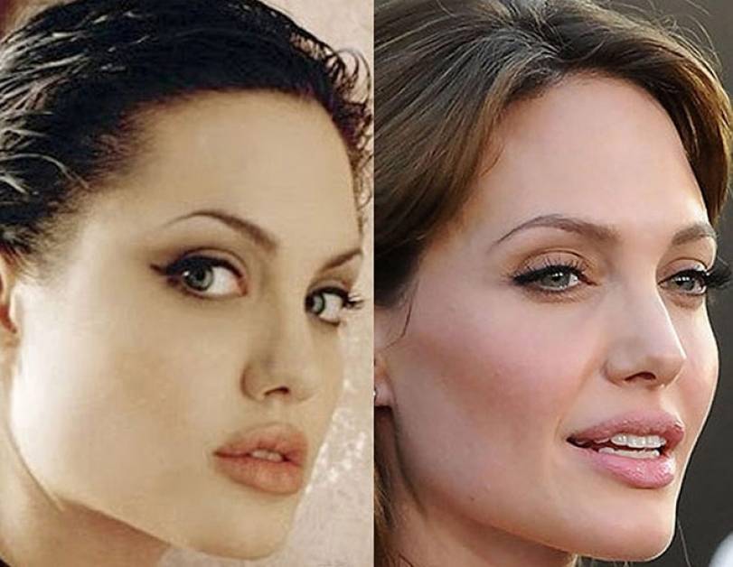 Анджелина джоли до и после пластики: фото актрисы, делала ли она пластические операции, новости и фото 2019