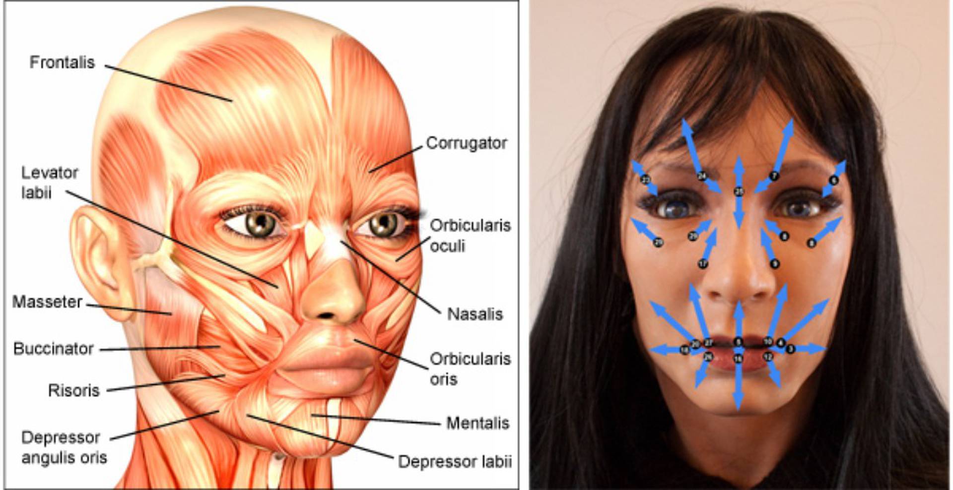 Ботокс: лицо до и после процедуры, что делает ботокс с лицом