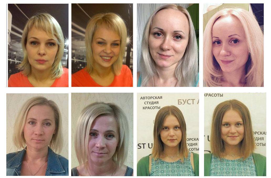 Boost up для волос: что это такое, как делается прикорневой объём, фото до и после