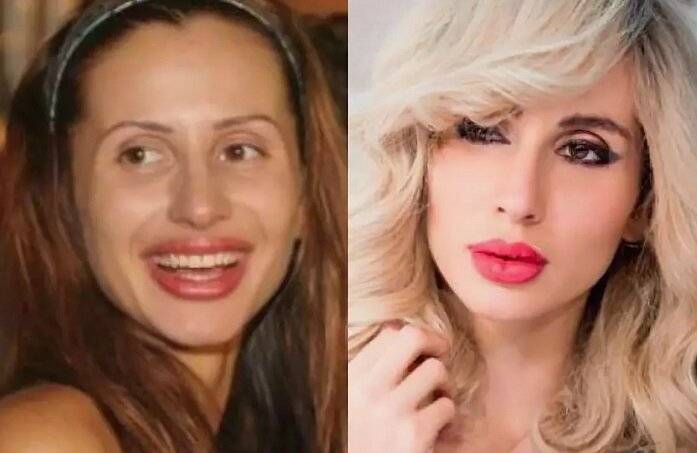 Светлана лобода до и после пластики, фото. певица лобода без макияжа и в молодости, фото