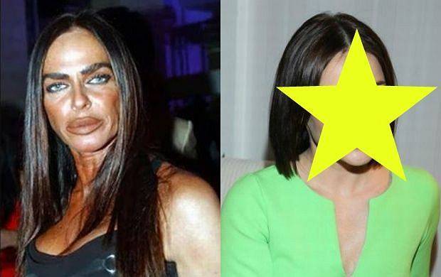 Жертвы пластической хирургии. фото до и после: знаменитости россии и звезды по всему миру, мужчины и женщины
