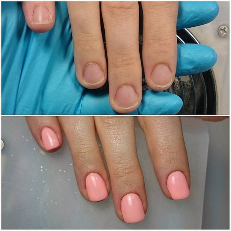 Форма ногтей трапеция. Ногти до и после. Ногти до и после маникюра. Наращивание ногтей до и после. Маникюр до и после.