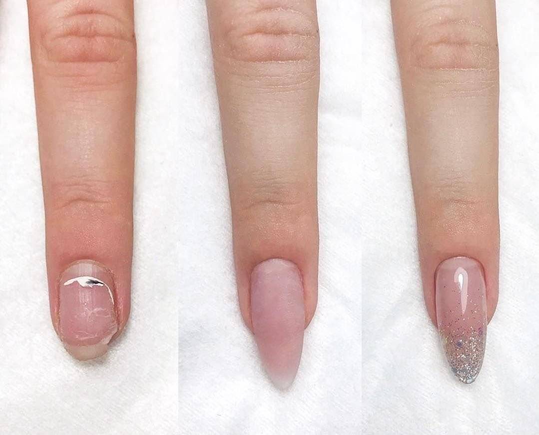 Коррекция нарощенных ногтей: что происходит со своим ногтем? | красивые ногти - дополнение твоего образа