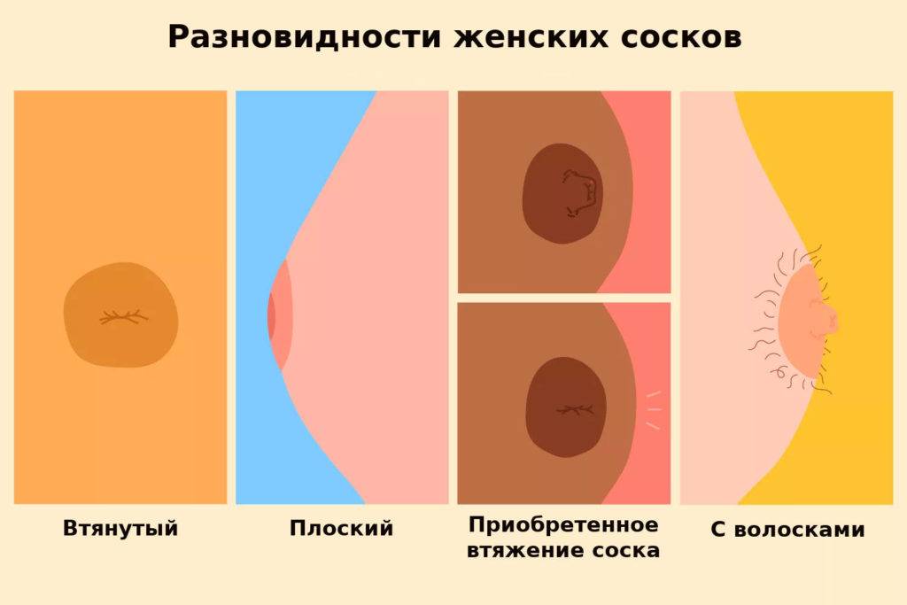Плоские и втянутые соски - ла лече лига россия